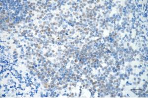 Immunohistochemistry was performed on paraffin-embedded human tonsillitis using PMS2 antibody (ABIN7799858), 1:200).