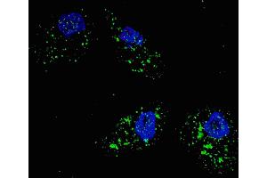 Fluorescent image of  cells stained with SQSTM1 (p62) (C-term) antibody.