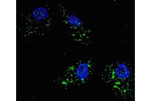 Fluorescent image of  cells stained with SQSTM1 (p62) (C-term) antibody. (SQSTM1 anticorps  (AA 317-346))