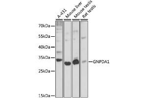 Western blot analysis of extracts of various cell lines, using GNPDA1 antibody (ABIN6292107) at 1:3000 dilution.