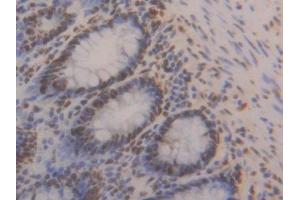 Detection of HNRPA2B1 in Human Rectum Tissue using Polyclonal Antibody to Heterogeneous Nuclear Ribonucleoprotein A2/B1 (HNRPA2B1)