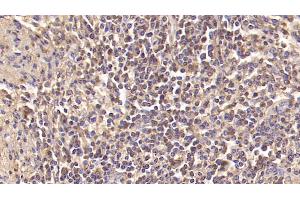 Detection of INSR in Human Spleen Tissue using Monoclonal Antibody to Insulin Receptor (INSR)