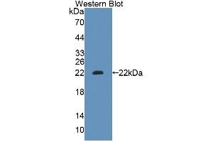 Detection of Recombinant GCDH, Human using Polyclonal Antibody to Glutaryl Coenzyme A Dehydrogenase (GCDH)