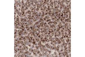 Immunohistochemical staining of human liver with TACC2 polyclonal antibody  shows strong cytoplasmic positivity in hepatocytes at 1:50-1:200 dilution.