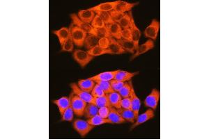 Immunofluorescence analysis of HeLa cells using RBP1 Rabbit pAb (ABIN6129597, ABIN6146795, ABIN6146796 and ABIN6214136) at dilution of 1:100 (40x lens).