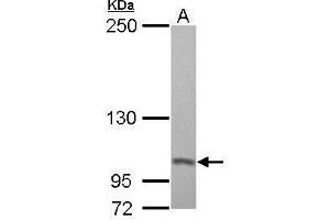 WB Image Sample (30 ug of whole cell lysate) A: A431 5% SDS PAGE antibody diluted at 1:500 (PSMD2 anticorps)