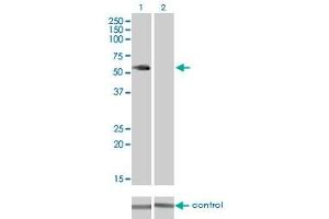 Western blot analysis of VRK2 over-expressed 293 cell line, cotransfected with VRK2 Validated Chimera RNAi (Lane 2) or non-transfected control (Lane 1).