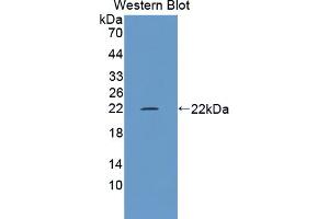 Western blot analysis of the recombinant protein. (TRPM7 anticorps  (AA 19-179))