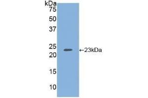 Detection of Recombinant HSPG, Human using Polyclonal Antibody to Heparan Sulfate Proteoglycan (HSPG) (HSPG anticorps  (AA 19-144))