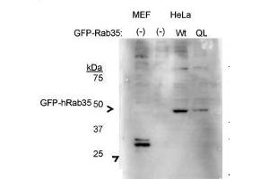 Human; RAB35 antibody - middle region validated by WB using HeLa cells, HEK293T cells at 1:500.