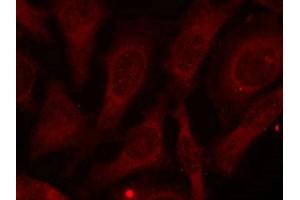 Immunofluorescence staining of methanol-fixed HeLa cells using CARM1 (Phospho-Ser228) antibody.
