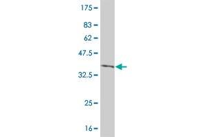 Western Blot detection against Immunogen (36. (IRAK2 anticorps  (AA 111-210))