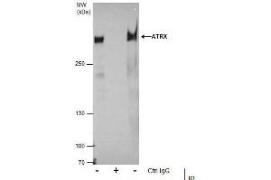 IP Image Immunoprecipitation of ATRX protein from 293T whole cell extracts using 5 μg of ATRX antibody [C3], C-term, Western blot analysis was performed using ATRX antibody [C3], C-term, EasyBlot anti-Rabbit IgG  was used as a secondary reagent. (ATRX anticorps  (C-Term))