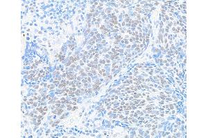 Immunohistochemistry (IHC) image for anti-Bromodomain Containing 9 (BRD9) (AA 547-597) antibody (ABIN7455162) (Recombinant BRD9 anticorps  (AA 547-597))
