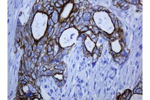 Image no. 3 for anti-Keratin 5 (KRT5) (AA 1-273) antibody (ABIN1490696)