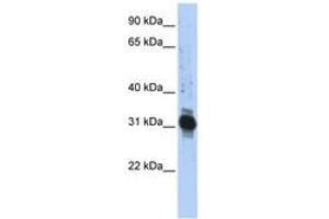 Image no. 1 for anti-Zinc Finger, AN1-Type Domain 3 (ZFAND3) (AA 72-121) antibody (ABIN6742474)