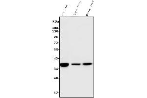 Western blot analysis of liver Arginase/ARG1 using anti-liver Arginase/ARG1 antibody (ABIN7600888).