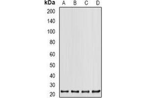 Western blot analysis of PSMB2 expression in K562 (A), HT29 (B), Hela (C), 22RV1 (D) whole cell lysates. (PSMB2 anticorps)