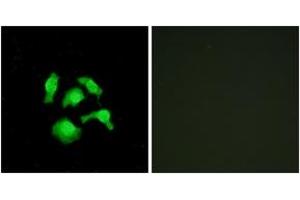 Immunofluorescence analysis of HepG2 cells, using TSC22D1 Antibody. (TSC22D1 anticorps  (AA 71-120))