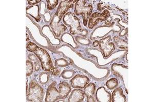 Immunohistochemical staining of human kidney with ZNF234 polyclonal antibody  shows strong cytoplasmic positivity in renal tubules. (ZNF226 anticorps)