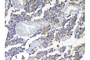 IHC analysis of Dnmt1 using anti-Dnmt1 antibody .