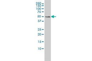 Western Blotting (WB) image for anti-Meis Homeobox 2 (MEIS2) (AA 1-382) antibody (ABIN598810) (MEIS2 anticorps  (AA 1-382))