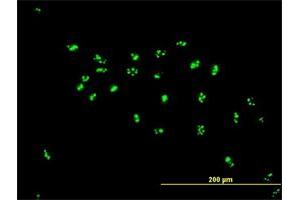 Immunofluorescence of purified MaxPab antibody to LYAR on HeLa cell. (LYAR anticorps  (AA 1-379))