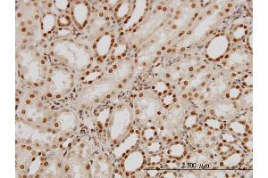 Immunoperoxidase of monoclonal antibody to PTBP1 on formalin-fixed paraffin-embedded human kidney.