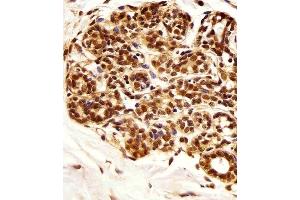 Immunohistochemical analysis of paraffin-embedded H. (PIN1 anticorps)