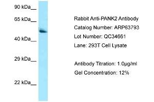 Western Blotting (WB) image for anti-Pantothenate Kinase 2 (PANK2) (C-Term) antibody (ABIN2789627) (PANK2 anticorps  (C-Term))