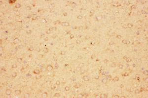 Anti-CNTF Picoband antibody,  IHC(P): Mouse Brain Tissue