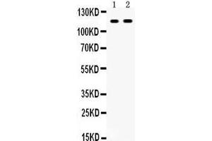 Anti- CD44 Picoband antibody, Western blotting All lanes: Anti CD44  at 0. (CD44 anticorps  (N-Term))