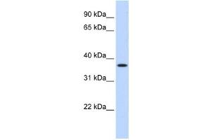 Western Blotting (WB) image for anti-Methylenetetrahydrofolate Dehydrogenase (NADP+ Dependent) 2, Methenyltetrahydrofolate Cyclohydrolase (MTHFD2) antibody (ABIN2458979) (MTHFD2 anticorps)