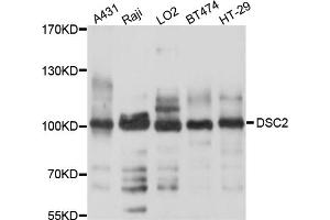 Western blot analysis of extracts of various cell lines, using DSC2 antibody (ABIN4903516) at 1:1000 dilution. (Desmocollin 2 anticorps)