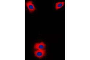 Immunofluorescent analysis of Cytochrome P450 11A1 staining in Jurkat cells.