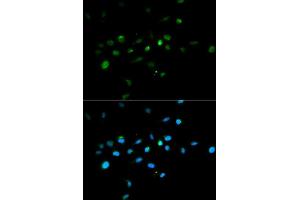 Immunofluorescence analysis of A549 cell using TRIM63 antibody. (TRIM63 anticorps)
