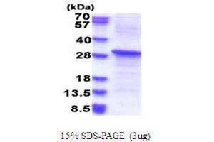 SDS-PAGE (SDS) image for REV1, Polymerase (DNA Directed) (REV1) (AA 51-256) protein (His tag) (ABIN5853688)