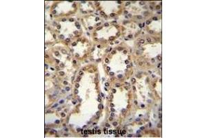 GPC6 Antibody (C-term) (ABIN655620 and ABIN2845100) immunohistochemistry analysis in formalin fixed and paraffin embedded human kidney tissue followed by peroxidase conjugation of the secondary antibody and DAB staining. (Glypican 6 anticorps  (C-Term))
