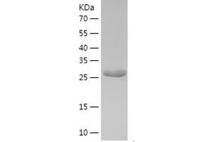 Western Blotting (WB) image for ATP Citrate Lyase (ACLY) (AA 4-265) protein (His-IF2DI Tag) (ABIN7121924)
