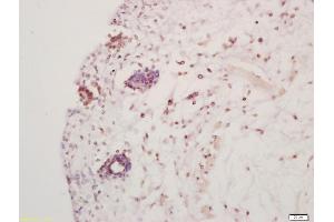Formalin-fixed and paraffin embedded mouse embryo labeled with Anti-Hes5 Polyclonal Antibody, Unconjugated (ABIN703811) at 1:200 followed by conjugation to the secondary antibody and DAB staining