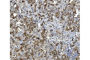 IHC analysis of PDIA5 using anti-PDIA5 antibody (ABIN7601801).