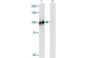 Western Blot analysis of NCAPH expression in transfected 293T cell line by NCAPH monoclonal antibody (M01), clone 1C9. (NCAPH anticorps  (AA 645-741))