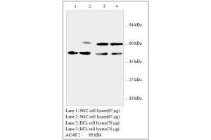 Image no. 1 for anti-Acetyl-CoA Acetyltransferase 2 (ACAT2) antibody (ABIN791348) (ACAT2 anticorps)