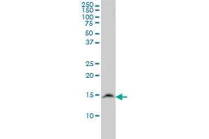 UBE2N monoclonal antibody (M02), clone 3G1-D10 Western Blot analysis of UBE2N expression in LNCaP . (UBE2N anticorps  (AA 1-152))