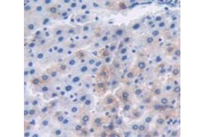 DAB staining on fromalin fixed paraffin- embedded Kidney tissue) (MT1 anticorps  (AA 1-61))