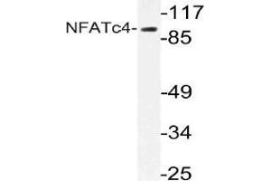 Western blot (WB) analysis of NFATc4 antibody in extracts from 293 cells.