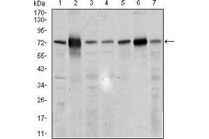 Western blot analysis using SLC27A5 mouse mAb against 3T3L1 (1), HepG2 (2), U937 (3), Raji (4), COS7 (5), NIH3T3 (6), and PC-3 (7) cell lysate. (SLC27A5 anticorps  (AA 508-570))