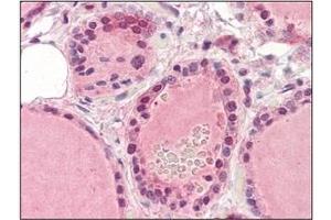 Immunohistochemistry (IHC) image for anti-EPH Receptor A2 (EPHA2) (AA 559-976) antibody (ABIN317512) (EPH Receptor A2 anticorps  (AA 559-976))
