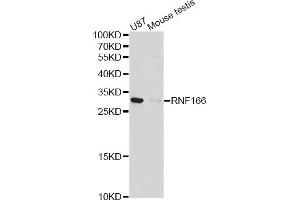 Western blot analysis of extracts of various cell lines, using RNF166 antibody (ABIN4905019) at 1:1000 dilution. (RNF166 anticorps)