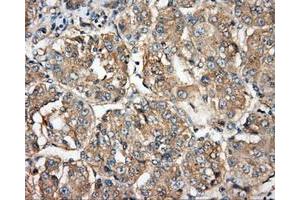 Image no. 4 for anti-Bruton Agammaglobulinemia tyrosine Kinase (BTK) antibody (ABIN1496974) (BTK anticorps)